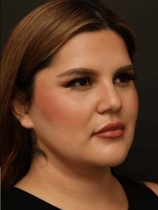 neck liposuction After