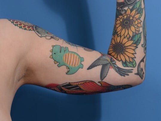 Arm Awake Lipo Before