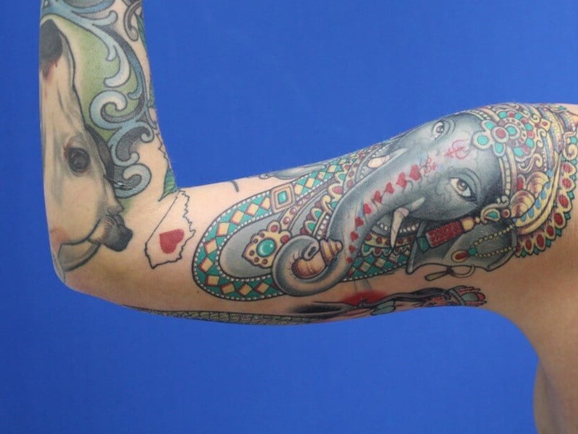 Arm Awake Lipo After