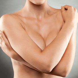 Breast Augmentation